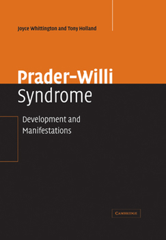 Paperback Prader-Willi Syndrome: Development and Manifestations Book