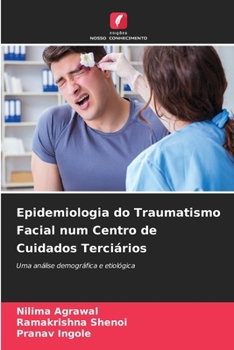 Epidemiologia do Traumatismo Facial num Centro de Cuidados Terciários (Portuguese Edition)