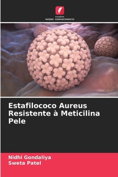 Paperback Estafilococo Aureus Resistente à Meticilina Pele (Portuguese Edition) [Portuguese] Book