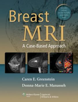 Hardcover Breast MRI: A Case-Based Approach [With Access Code] Book