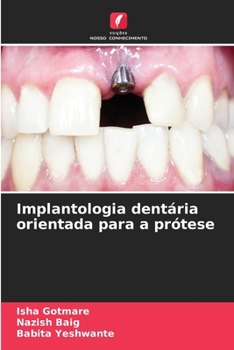 Paperback Implantologia dentária orientada para a prótese [Portuguese] Book