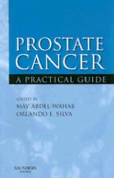 Paperback Prostate Cancer: A Practical Guide Book