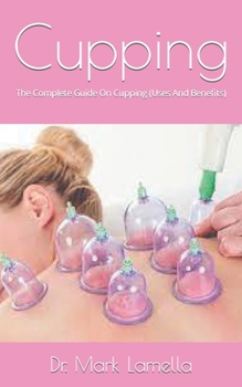 Cupping: The Complete Guide On Cupping