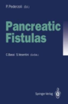 Paperback Pancreatic Fistulas Book