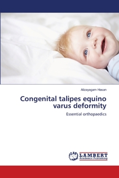 Paperback Congenital talipes equino varus deformity Book