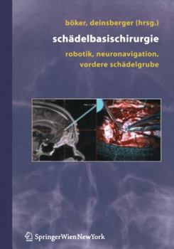 Paperback Schädelbasischirurgie: Robotik, Neuronavigation, Vordere Schädelgrube [German] Book