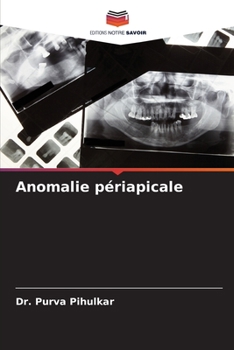 Paperback Anomalie périapicale [French] Book
