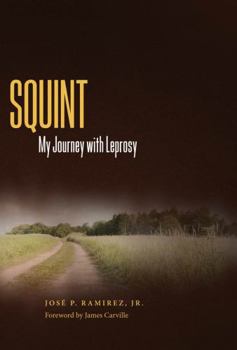 Hardcover Squint: My Journey with Leprosy Book