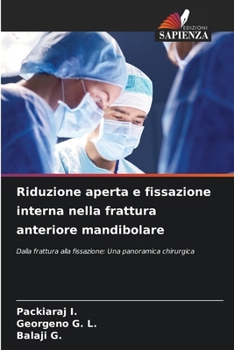 Riduzione aperta e fissazione interna nella frattura anteriore mandibolare (Italian Edition)