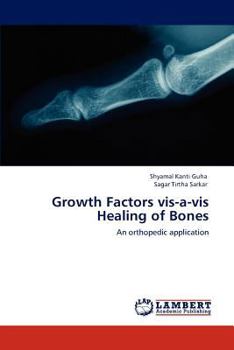 Paperback Growth Factors vis-a-vis Healing of Bones Book