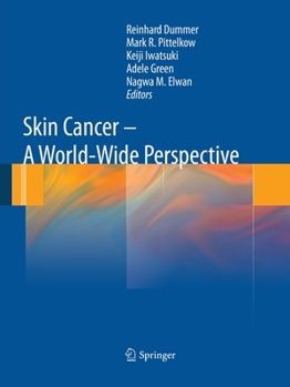 Paperback Skin Cancer - A World-Wide Perspective Book