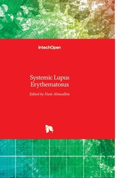 Hardcover Systemic Lupus Erythematosus Book