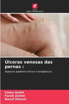 Paperback Úlceras venosas das pernas [Portuguese] Book