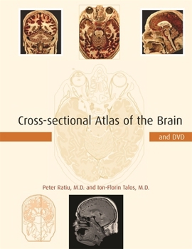 Hardcover Cross-Sectional Atlas of the Brain and DVD [With DVD-ROM] Book