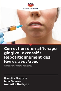 Paperback Correction d'un affichage gingival excessif: Repositionnement des lèvres avec/avec [French] Book