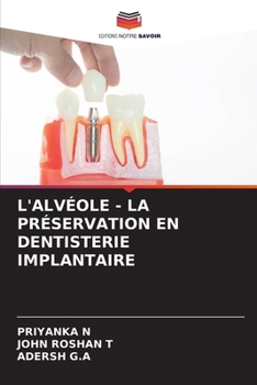 L'Alvéole - La Préservation En Dentisterie Implantaire (French Edition)