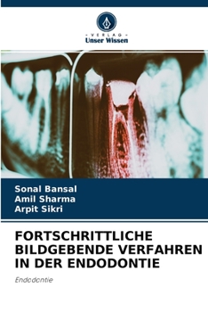 Paperback Fortschrittliche Bildgebende Verfahren in Der Endodontie [German] Book