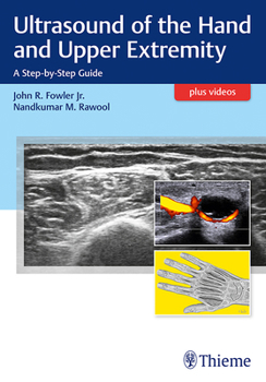 Paperback Ultrasound of the Hand and Upper Extremity: A Step-By-Step Guide Book
