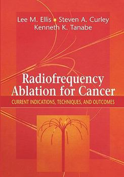 Paperback Radiofrequency Ablation for Cancer: Current Indications, Techniques, and Outcomes Book