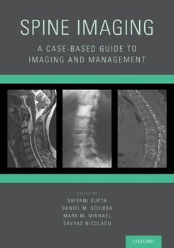 Paperback Spine Imaging: A Case-Based Guide to Imaging and Management Book