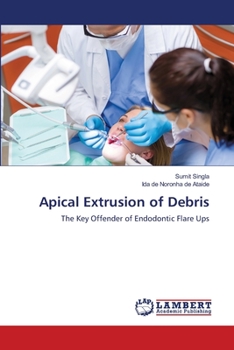 Paperback Apical Extrusion of Debris Book