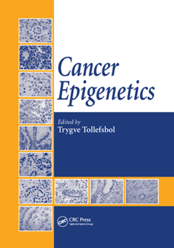 Paperback Cancer Epigenetics Book