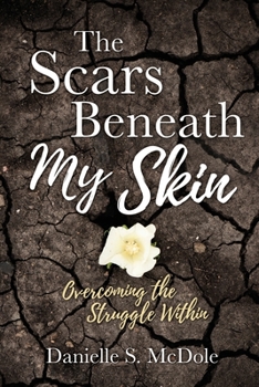 Paperback The Scars Beneath My Skin: Overcoming the Struggle Within Book