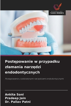Paperback Post&#281;powanie w przypadku zlamania narz&#281;dzi endodontycznych [Polish] Book