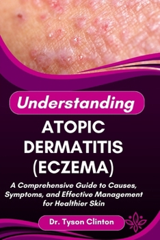Paperback Understanding Atopic Dermatitis (Eczema): A Comprehensive Guide to Causes, Symptoms, and Effective Management for Healthier Skin Book