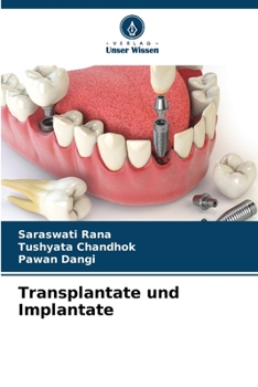 Paperback Transplantate und Implantate [German] Book