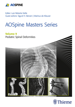 Hardcover Aospine Masters Series, Volume 9: Pediatric Spinal Deformities Book