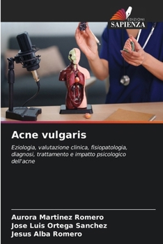 Acne vulgaris (Italian Edition)