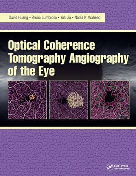 Paperback Optical Coherence Tomography Angiography of the Eye: Oct Angiography Book