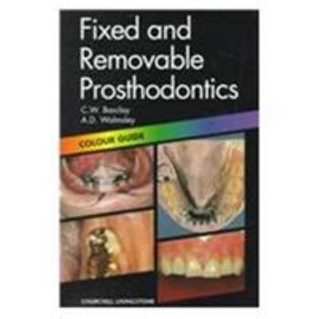 Paperback Fixed and Removable Prosthodontics: Colour Guide Book
