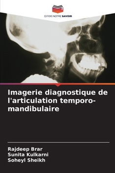 Imagerie diagnostique de l'articulation temporo-mandibulaire (French Edition)