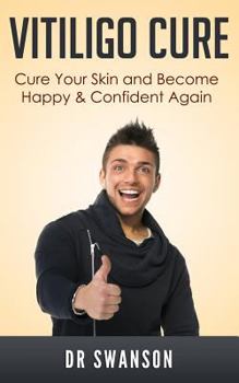 Paperback Vitiligo Cure: Cure your Skin and Become Happy & Confident Again Book