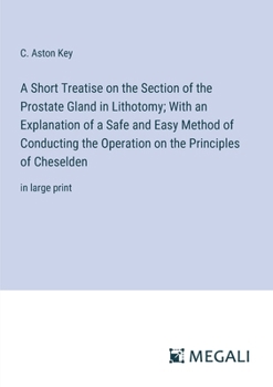 Paperback A Short Treatise on the Section of the Prostate Gland in Lithotomy; With an Explanation of a Safe and Easy Method of Conducting the Operation on the P Book