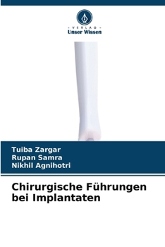 Chirurgische Führungen bei Implantaten (German Edition)