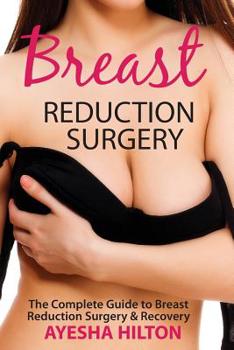 Paperback Breast Reduction Surgery: The Complete Guide to Breast Reduction Surgery & Recovery Book