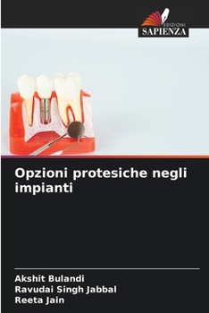 Opzioni protesiche negli impianti (Italian Edition)
