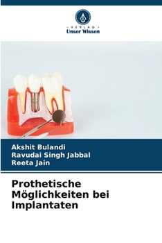 Paperback Prothetische Möglichkeiten bei Implantaten [German] Book