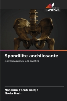 Paperback Spondilite anchilosante [Italian] Book