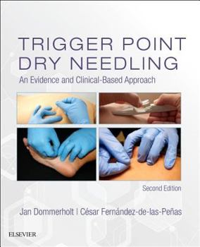 Hardcover Trigger Point Dry Needling: An Evidence and Clinical-Based Approach Book