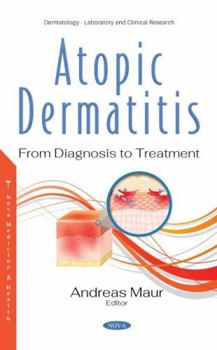 Hardcover Atopic Dermatitis: From Diagnosis to Treatment Book