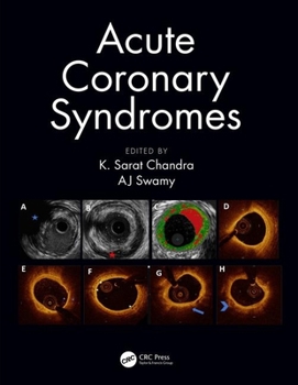 Paperback Acute Coronary Syndromes Book