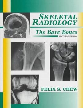 Hardcover Skeletal Radiology: The Bare Bones Book