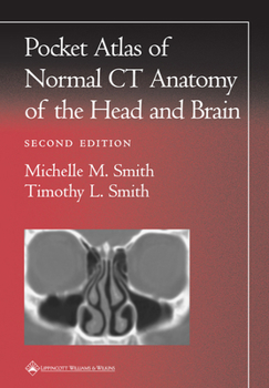 Paperback Pocket Atlas of Normal CT Anatomy of the Head and Brain Book