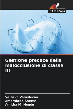 Paperback Gestione precoce della malocclusione di classe III [Italian] Book