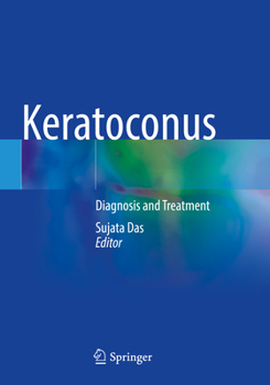 Paperback Keratoconus: Diagnosis and Treatment Book