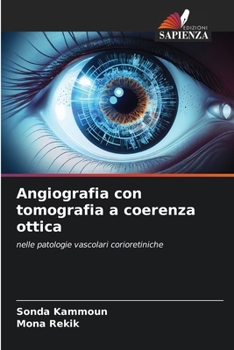 Paperback Angiografia con tomografia a coerenza ottica [Italian] Book